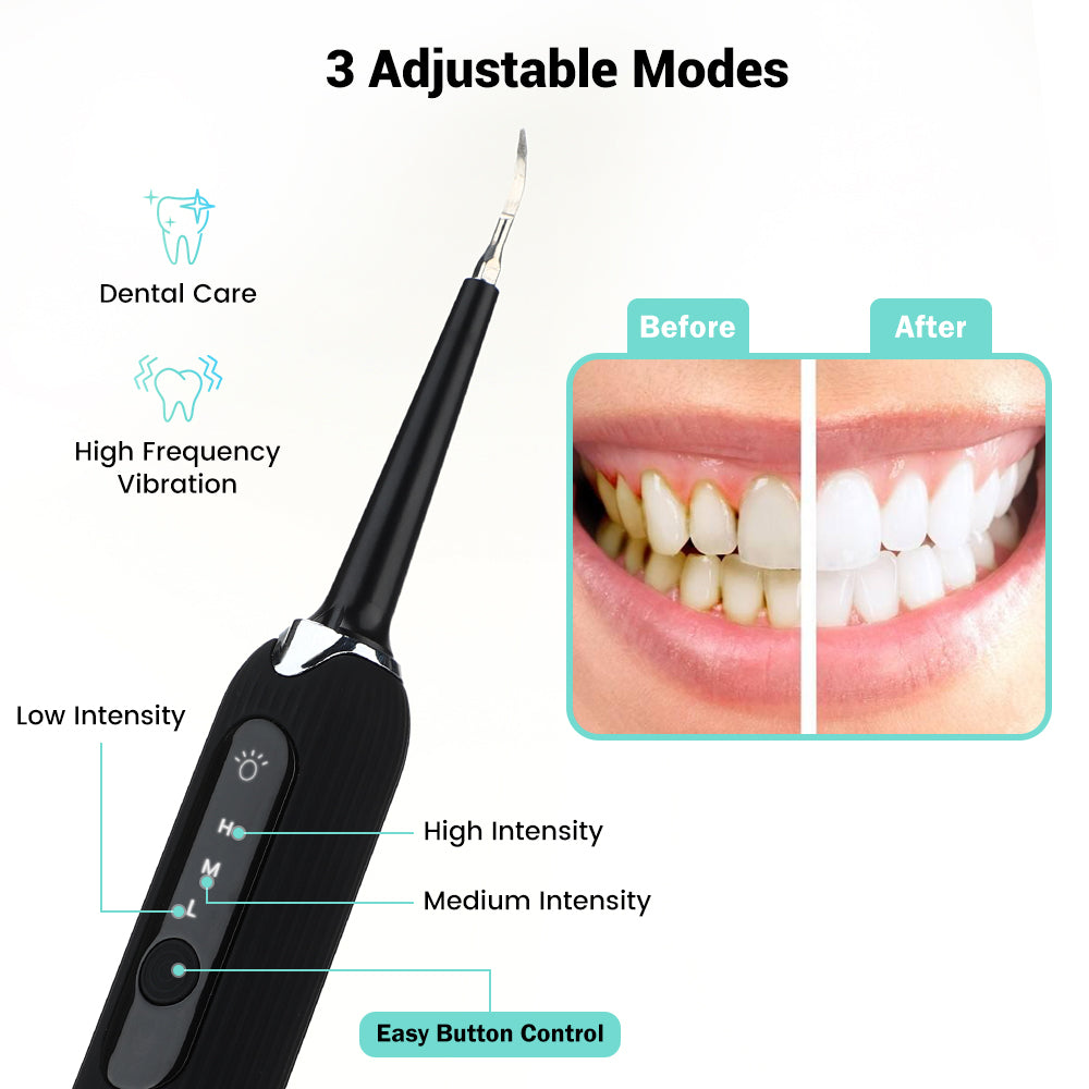 Ultrasonic Tooth Cleaner Pro - Smile Therapy
