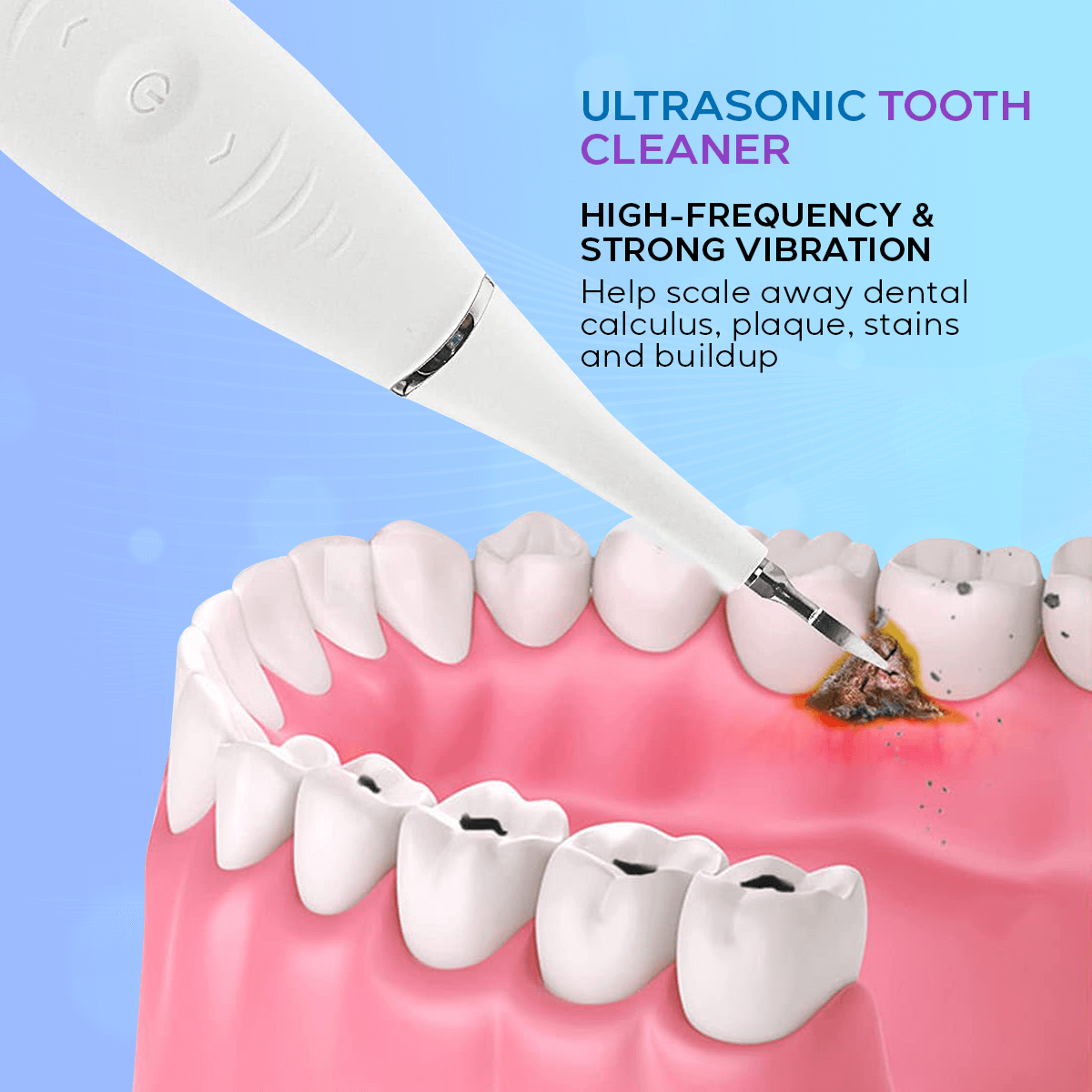 Ultrasonic Tooth Cleaner - Plaque Remover - Smile Therapy