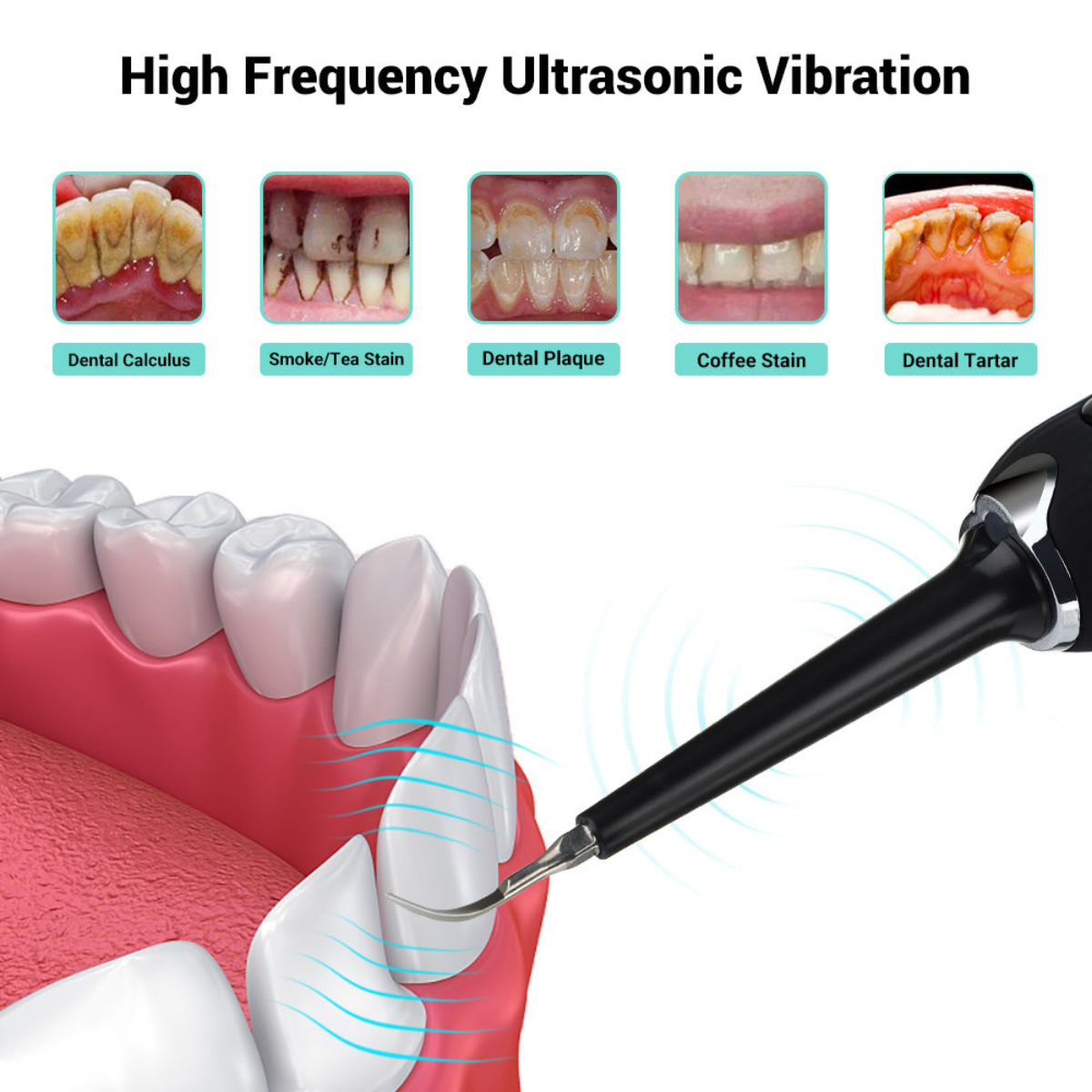 Ultrasonic Tooth Cleaner Pro - Smile Therapy